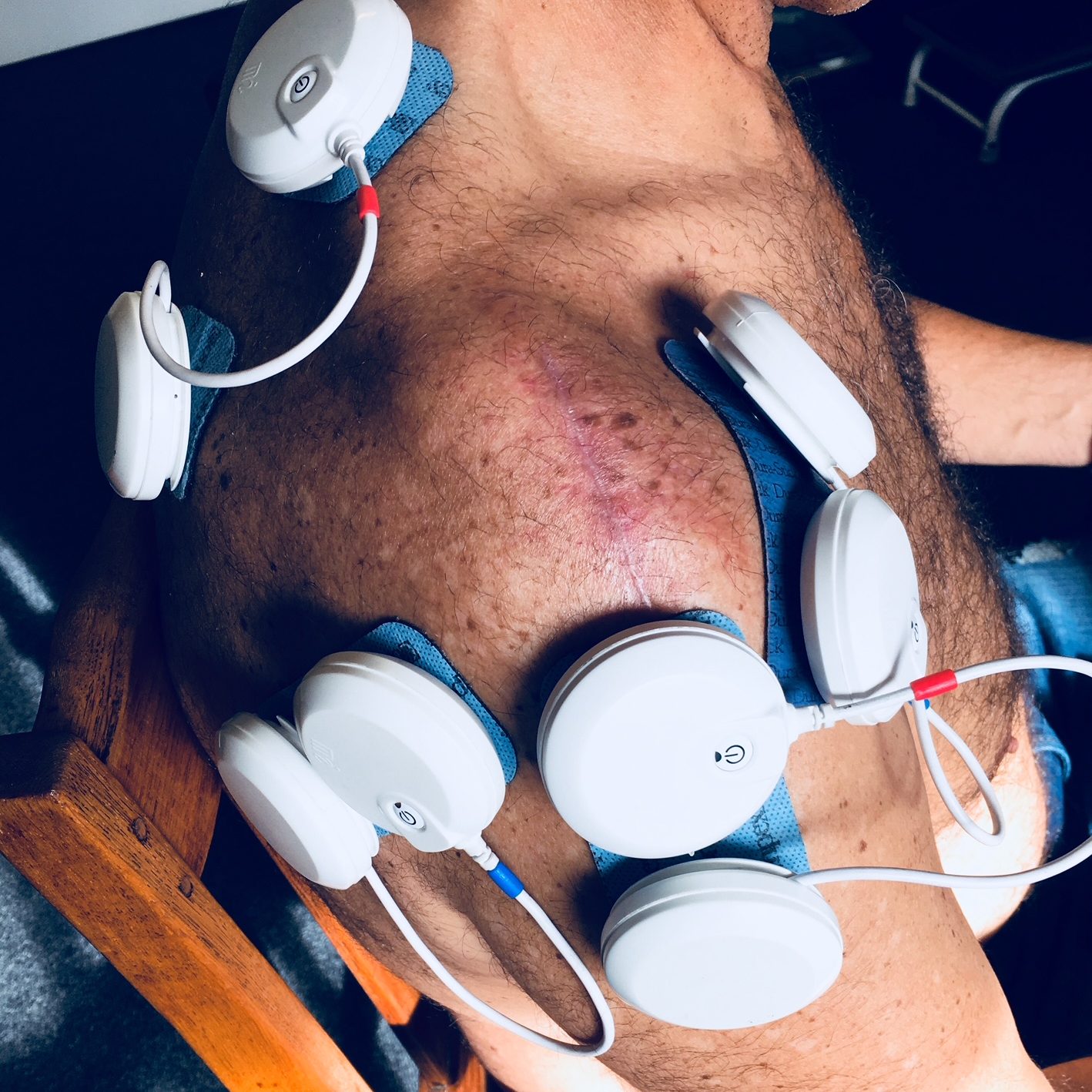 Rehabilitation